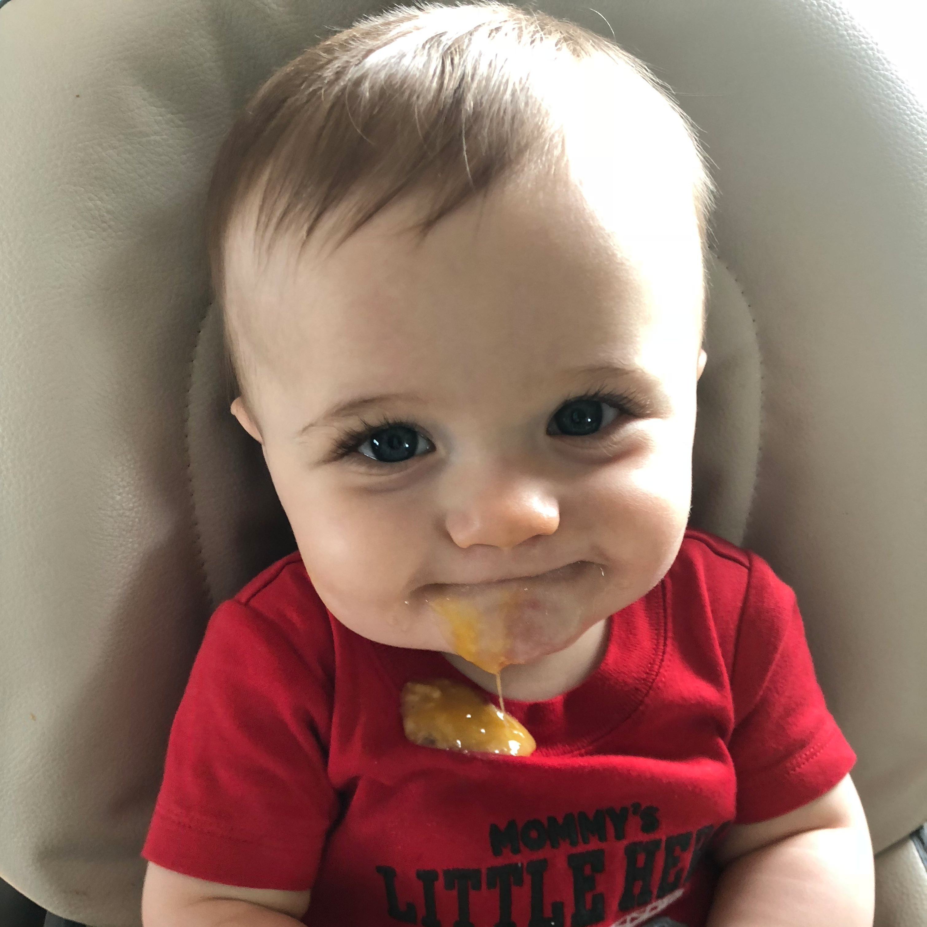 Food allergy vomiting